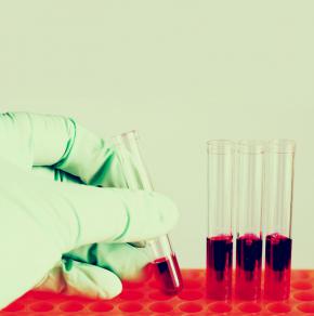 Problems With Industry’s Reform